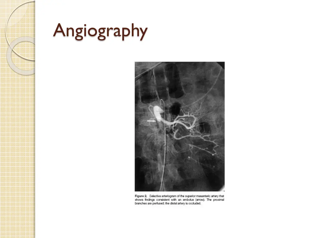 angiography