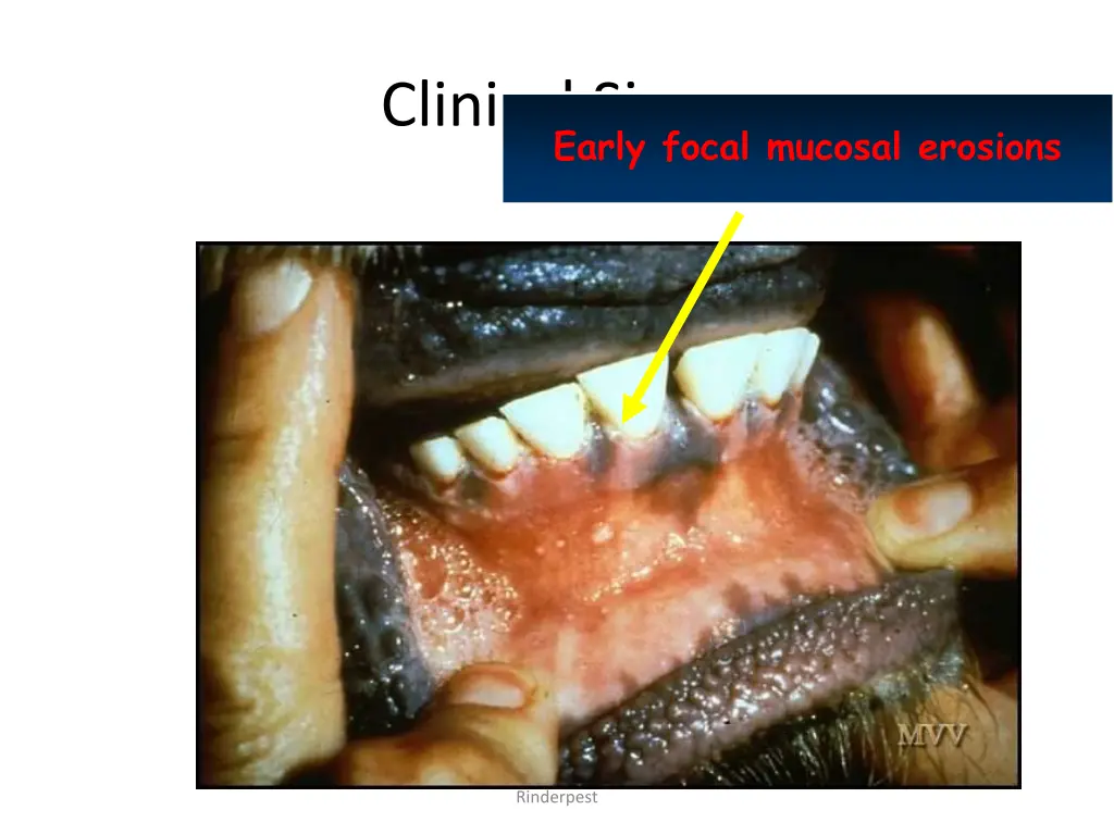 clinical signs early focal mucosal erosions