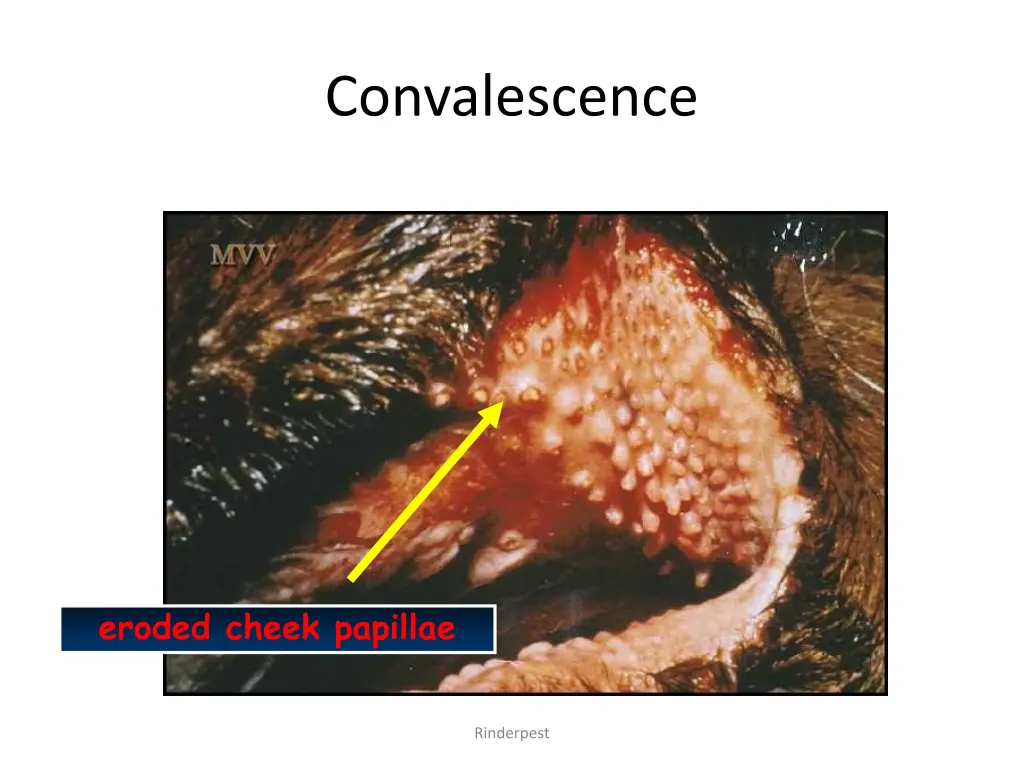 convalescence 1