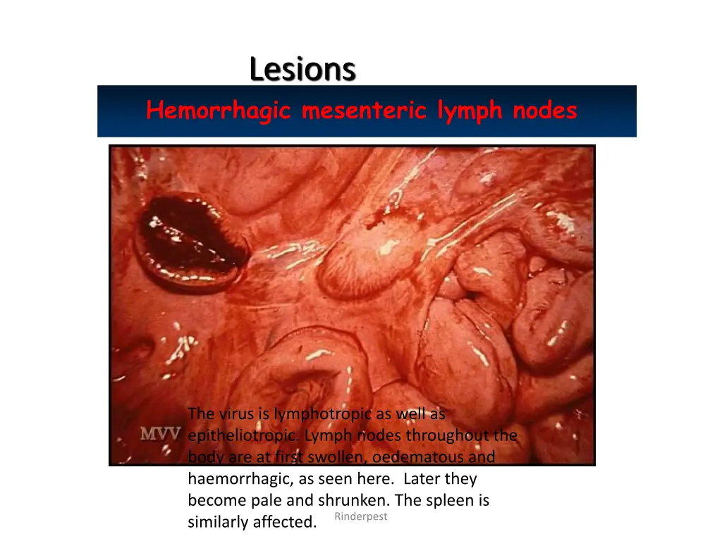 lesions 2