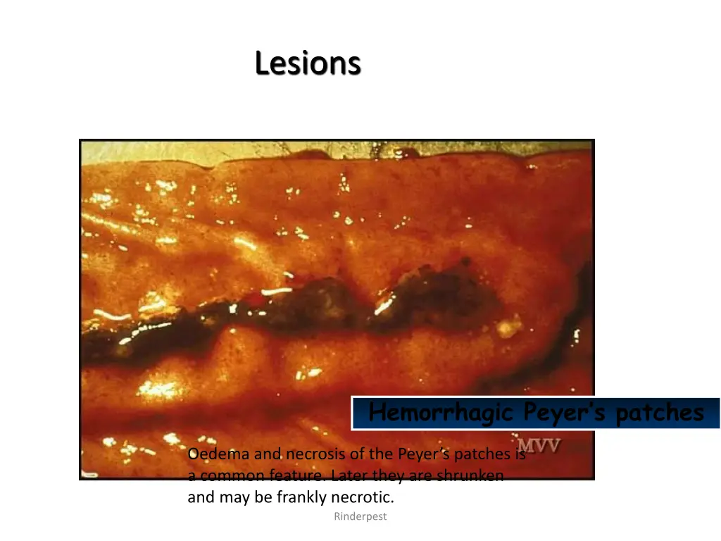 lesions 5