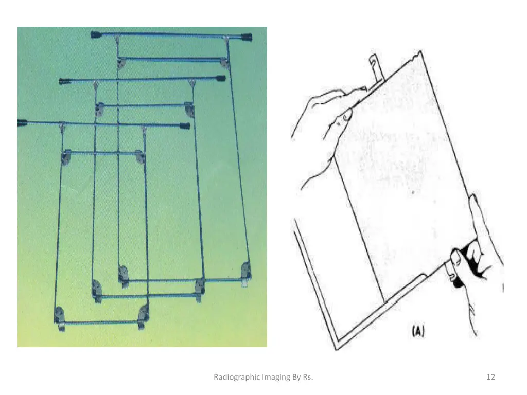 radiographic imaging by rs