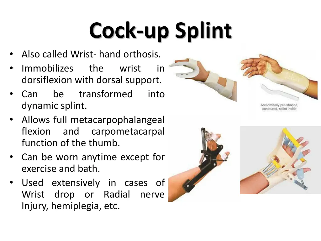 cock up splint