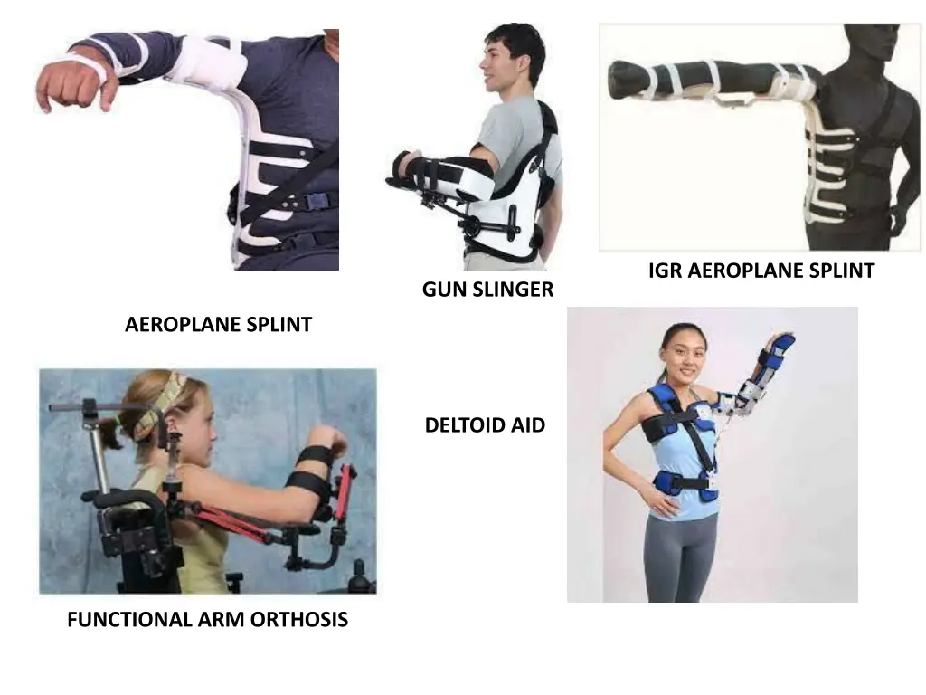 igr aeroplane splint