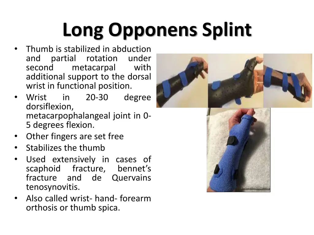 long opponens splint thumb is stabilized