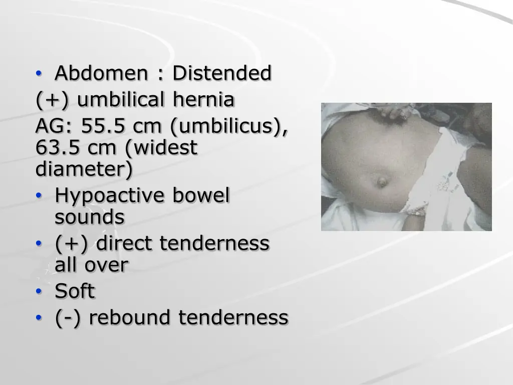 abdomen distended umbilical hernia