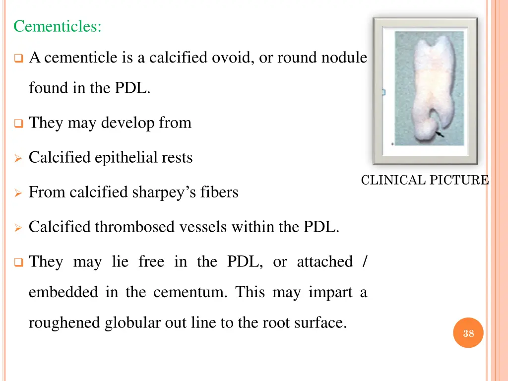 cementicles