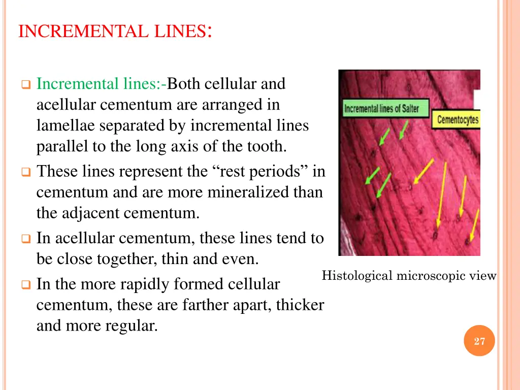 incremental lines