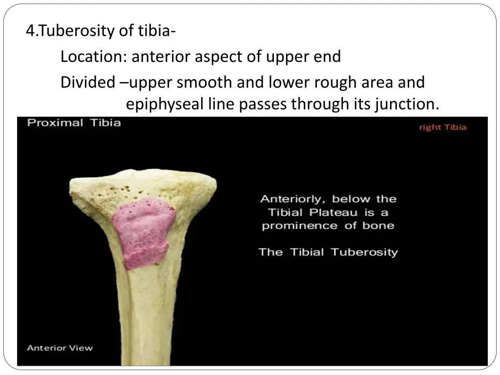 4 tuberosity of tibia location anterior aspect