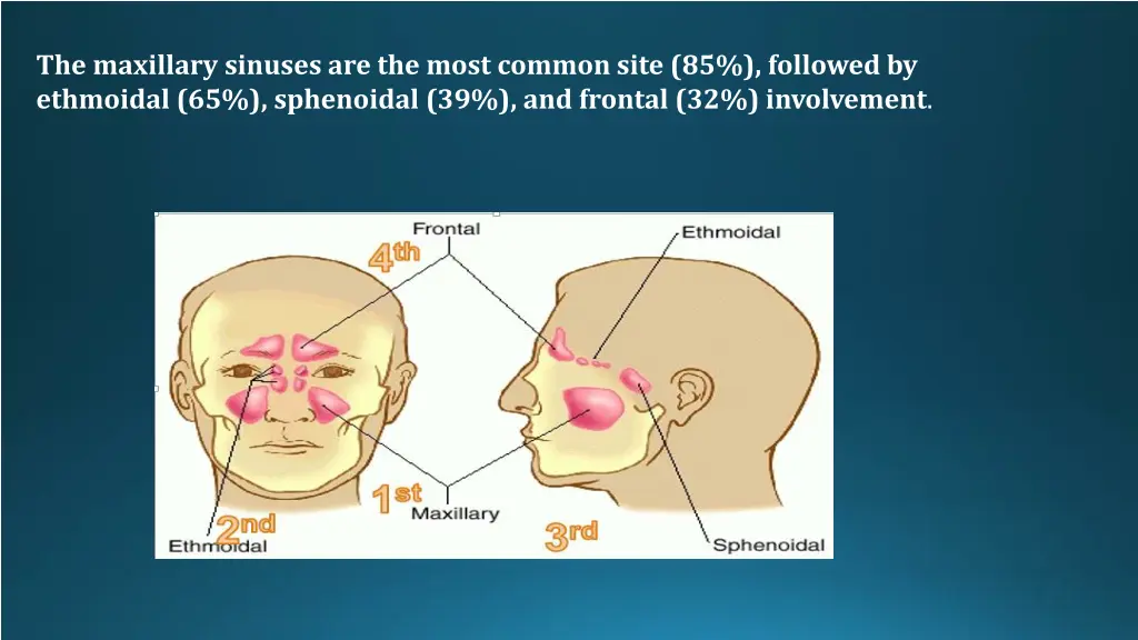 the maxillary sinuses are the most common site