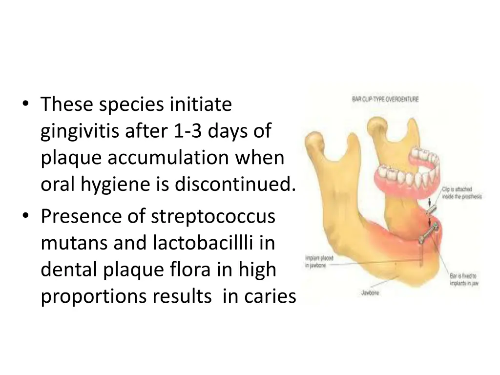 these species initiate gingivitis after 1 3 days