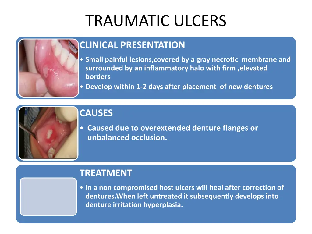 traumatic ulcers