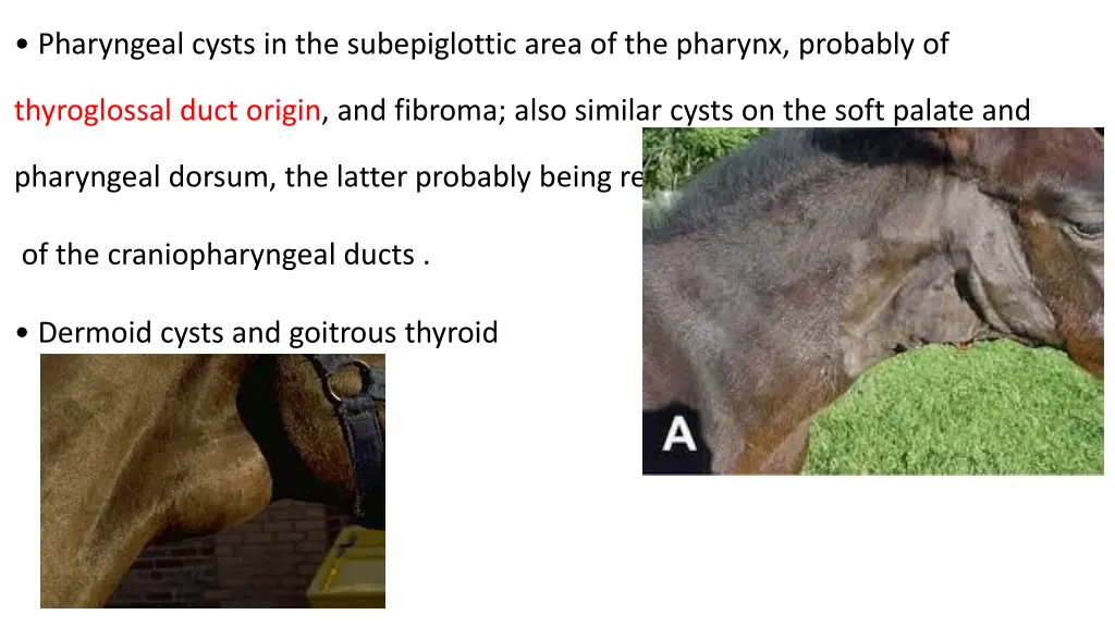 pharyngeal cysts in the subepiglottic area