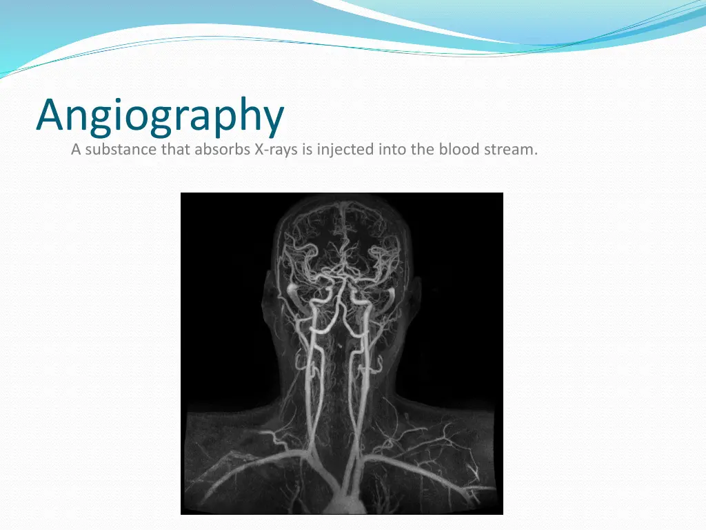 angiography a substance that absorbs x rays