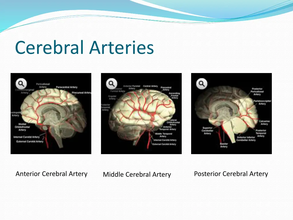 cerebral arteries