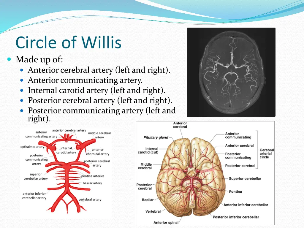 circle of willis made up of anterior cerebral