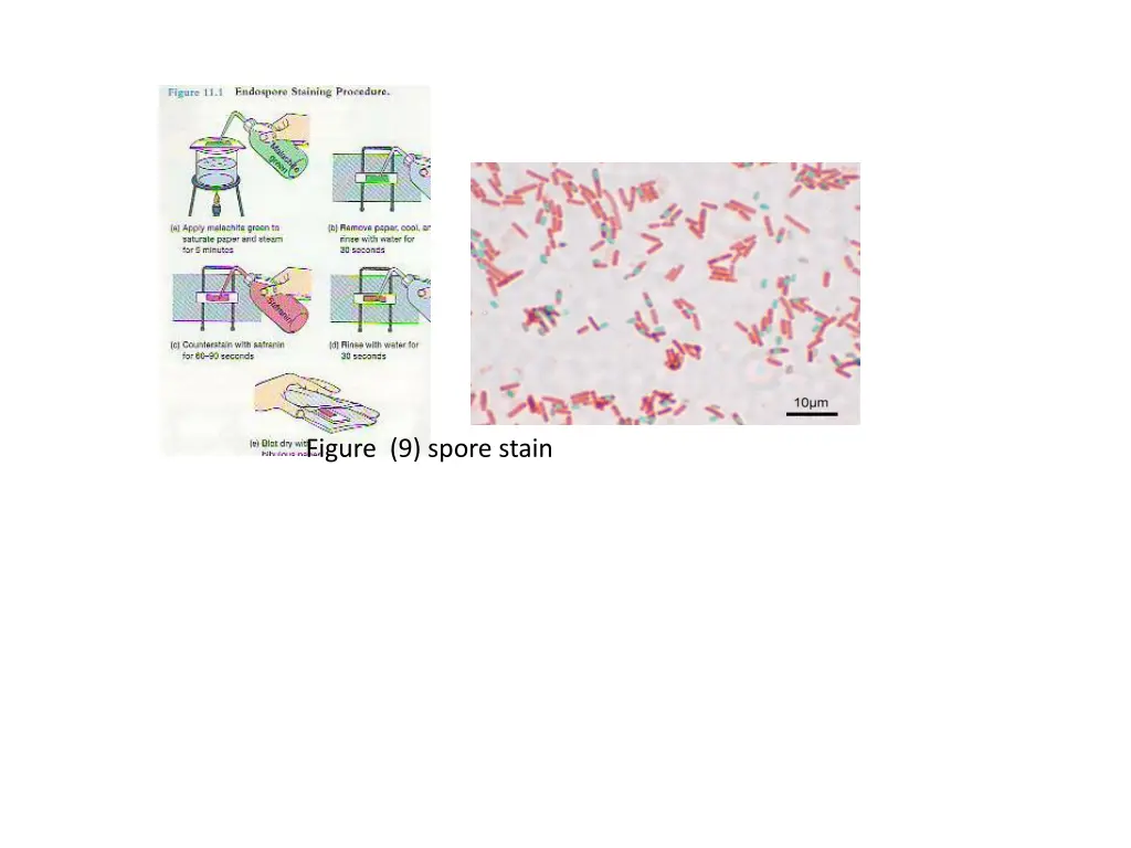 figure 9 spore stain