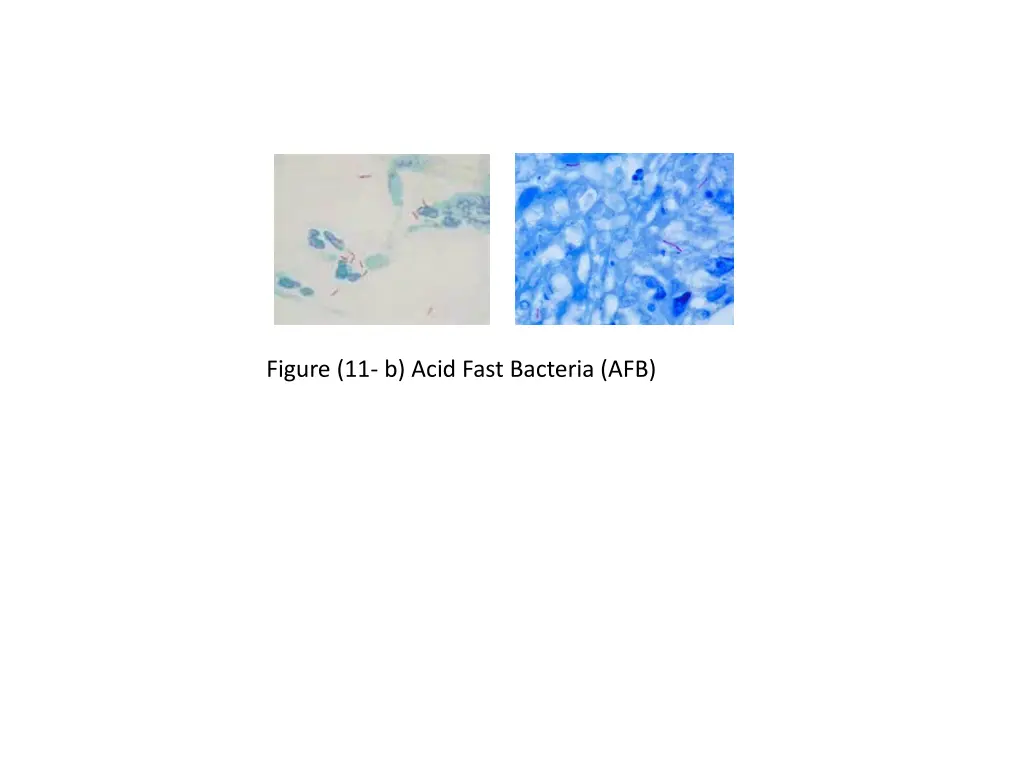 file mycobacterium tuberculosis ziehl neelsen