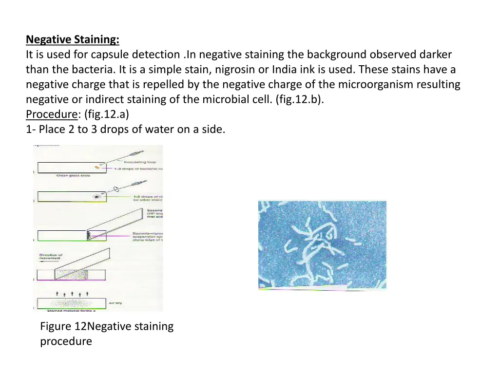 negative staining it is used for capsule