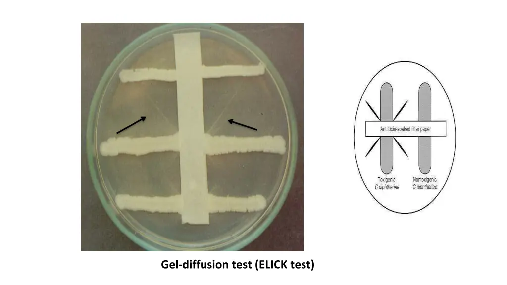 gel diffusion test elick test