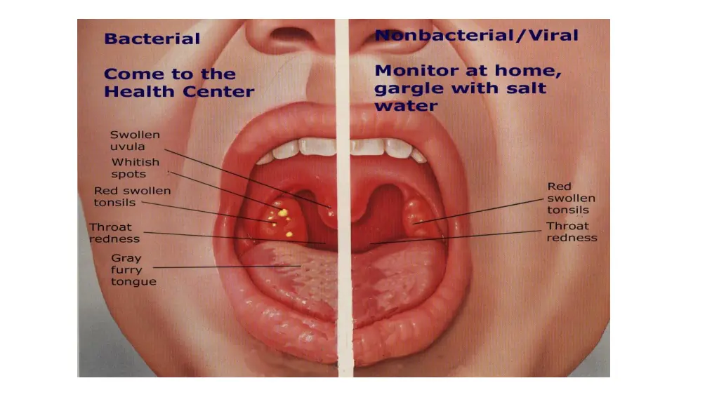 slide5