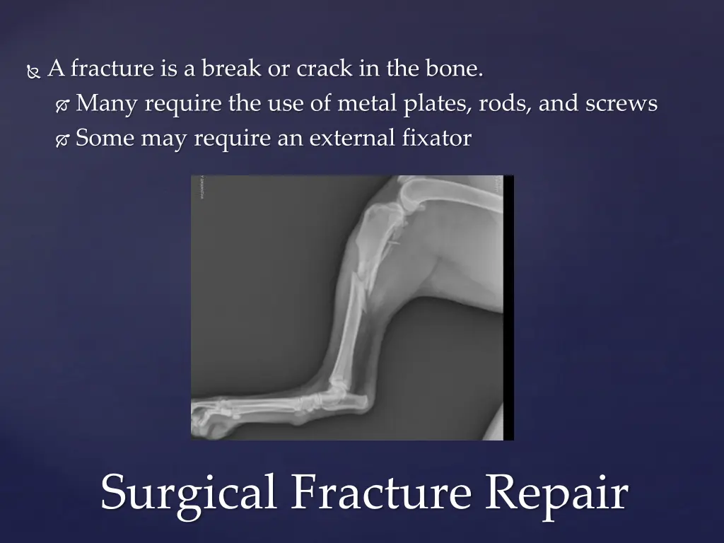 a fracture is a break or crack in the bone