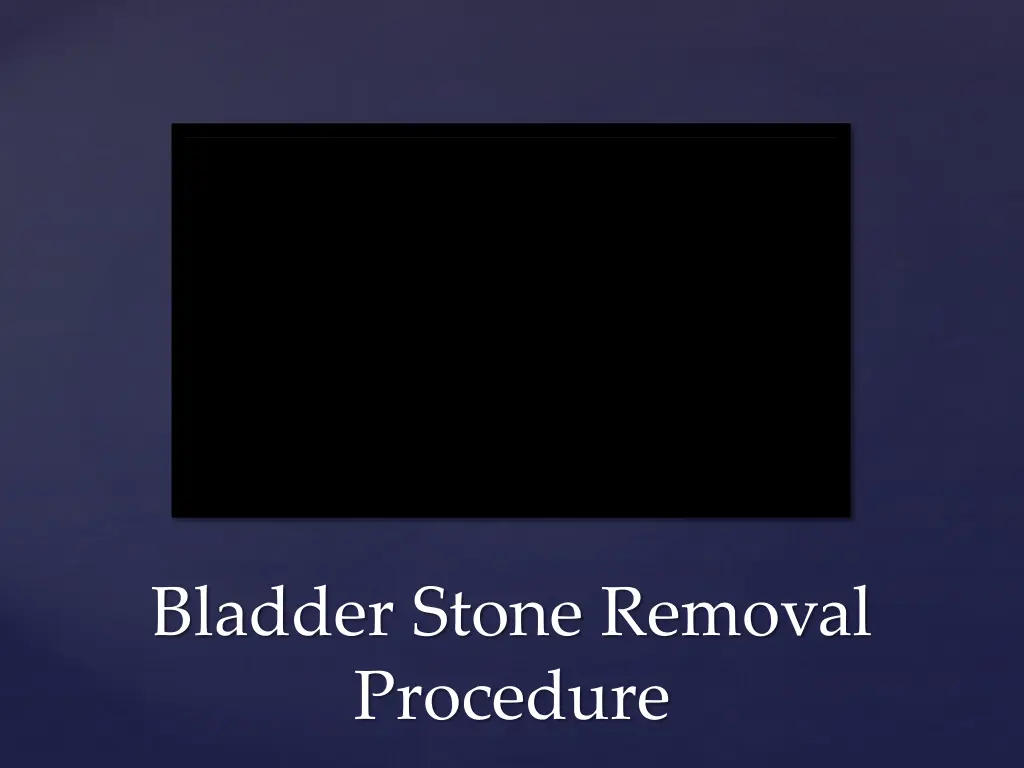 bladder stone removal procedure