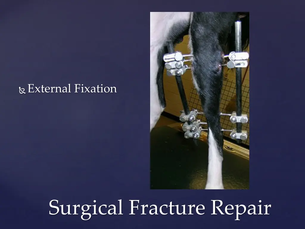 external fixation