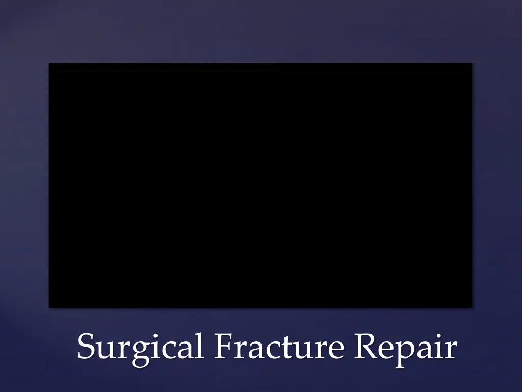 surgical fracture repair