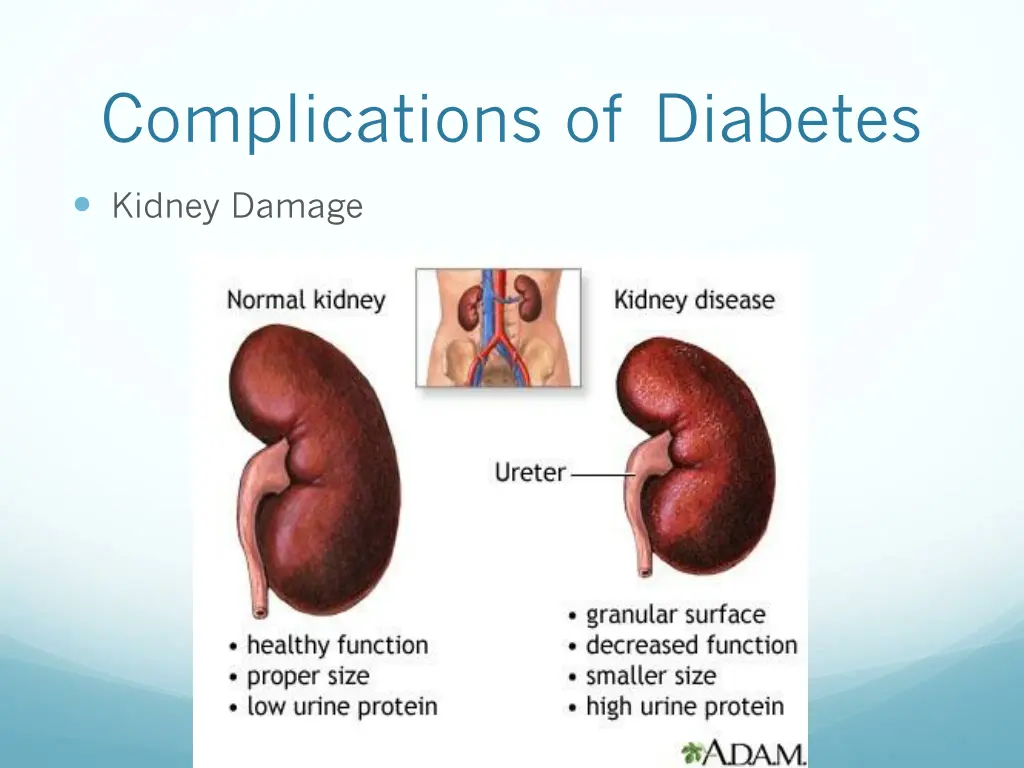 complications of diabetes 2