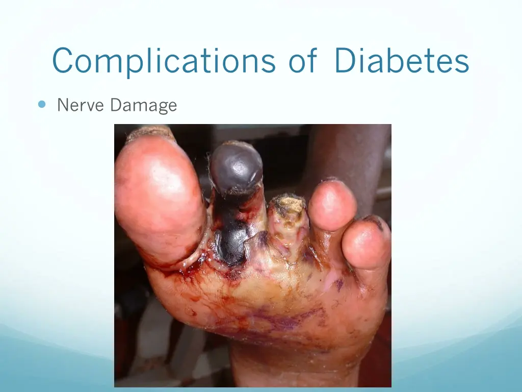 complications of diabetes 3