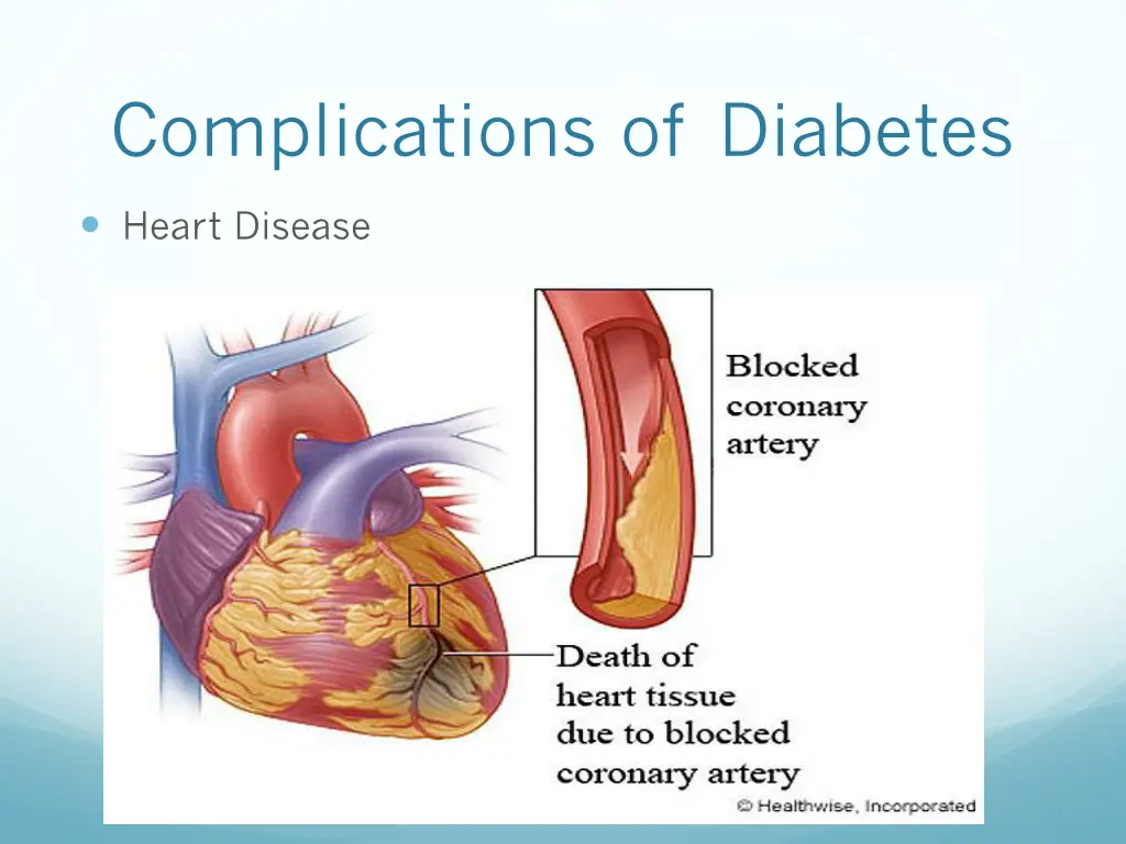 complications of diabetes