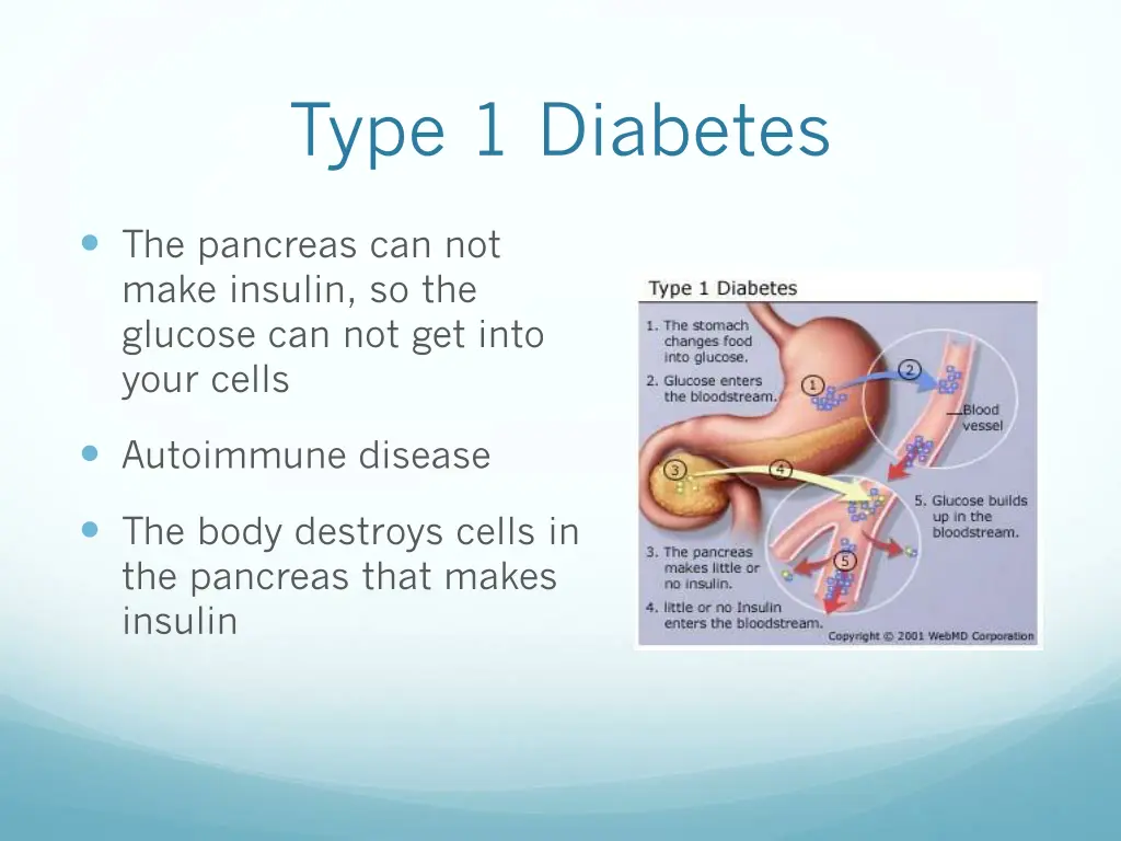 type 1 diabetes