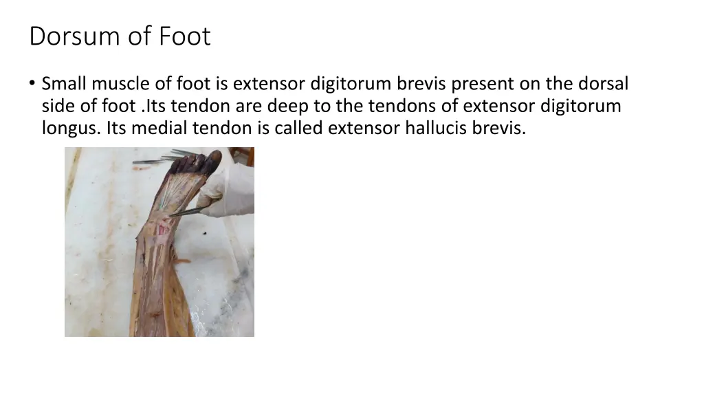 dorsum of foot