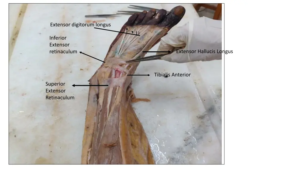 extensor digitorum longus