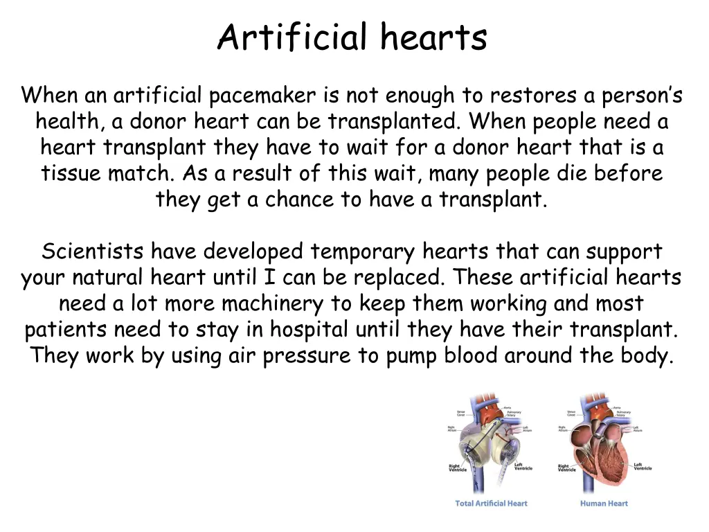 artificial hearts