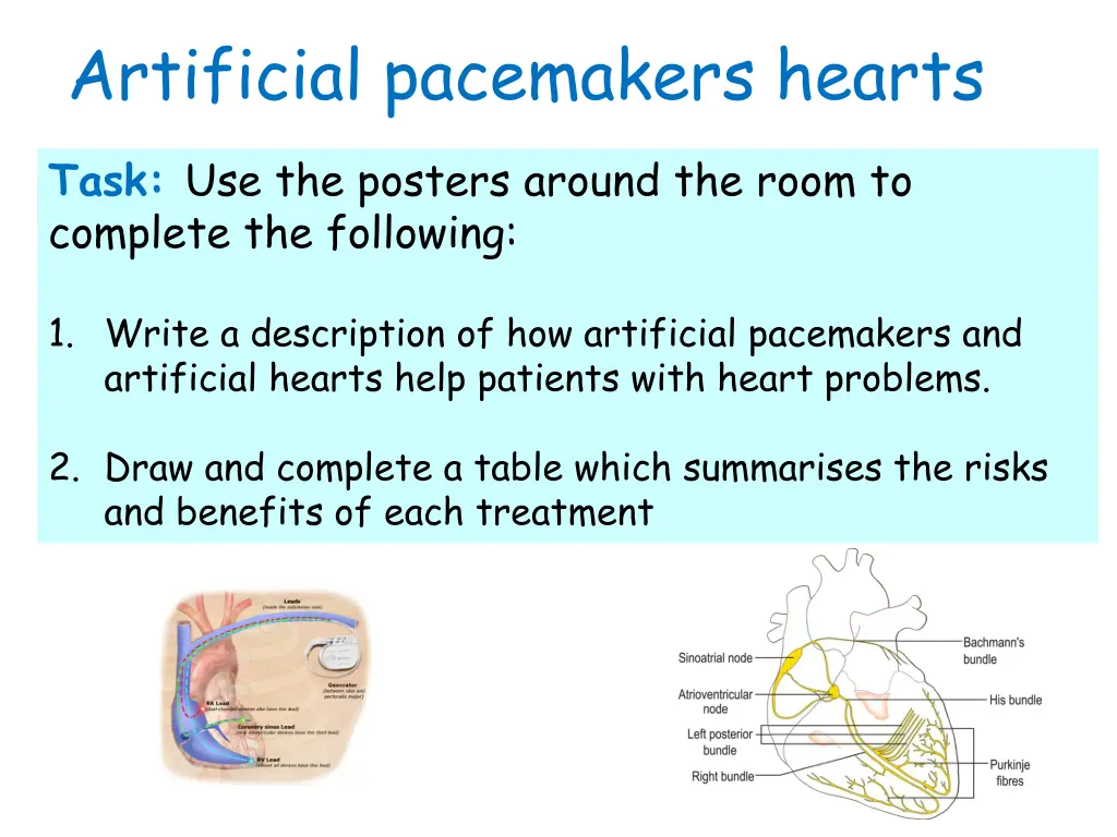 artificial pacemakers hearts