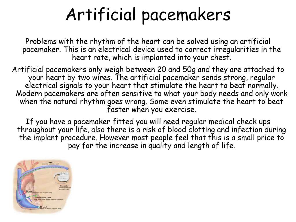 artificial pacemakers