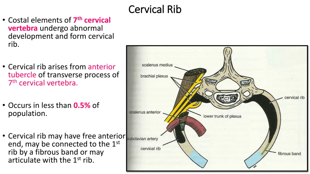 cervical rib cervical rib