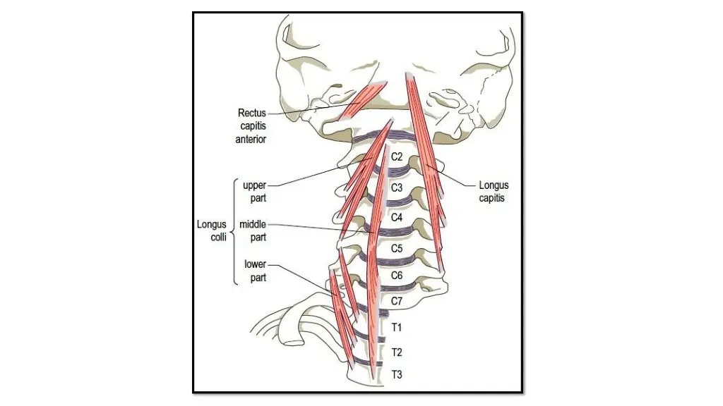 slide15