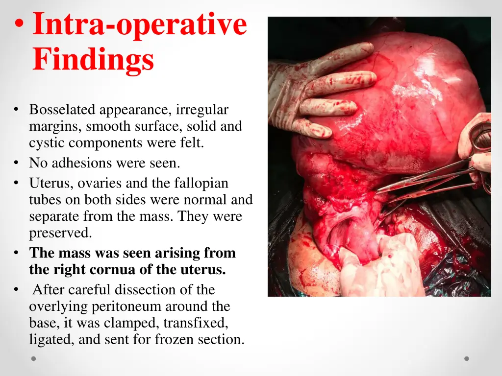 intra operative findings