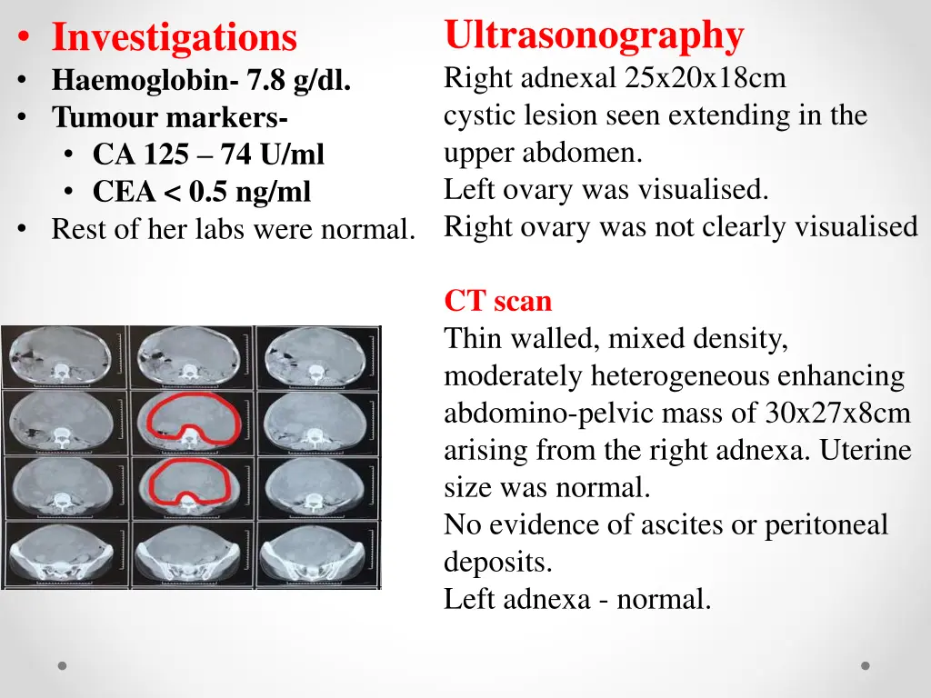 ultrasonography right adnexal 25x20x18cm cystic