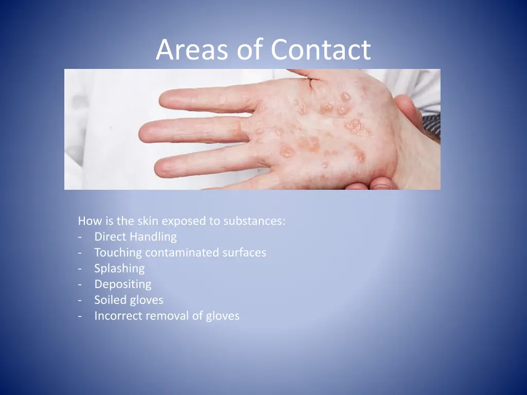 areas of contact