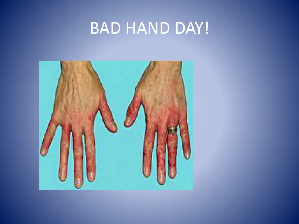 bad hand day