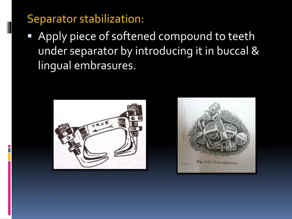 separator stabilization apply piece of softened