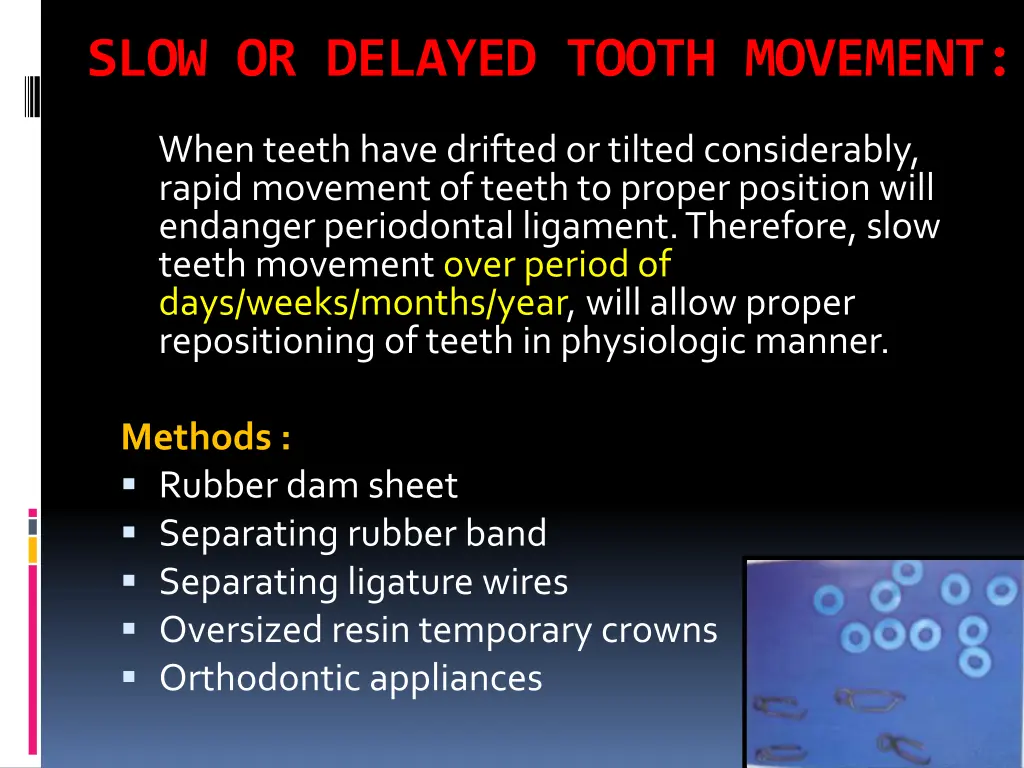 slow or delayed tooth movement