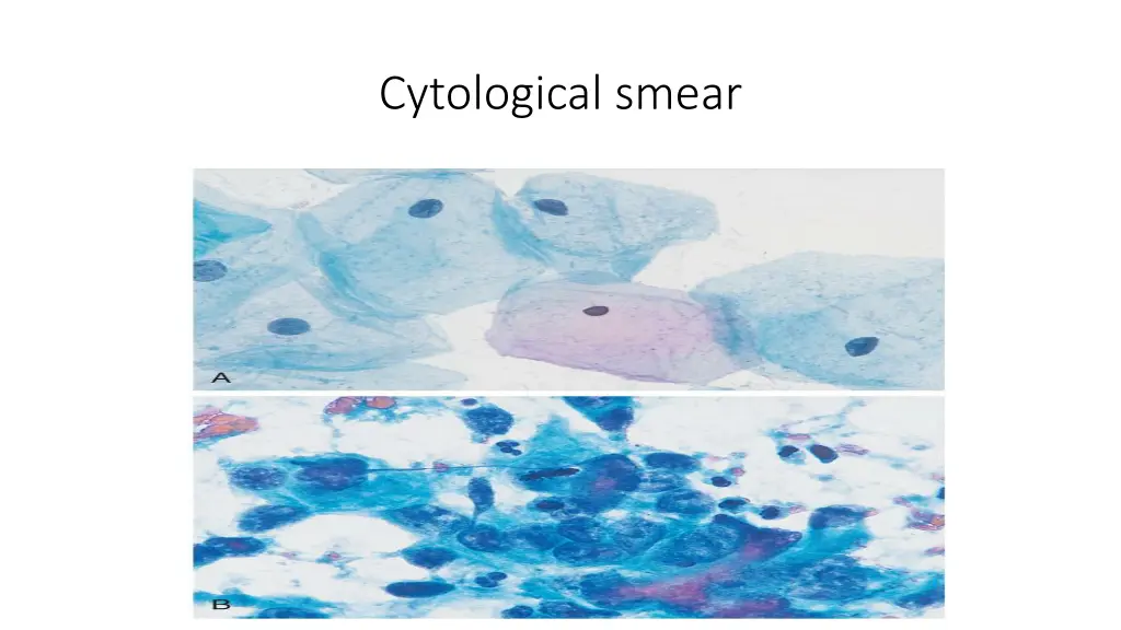 cytological smear