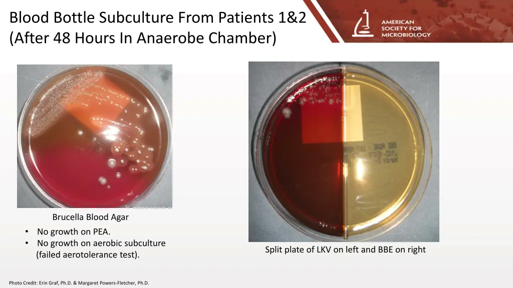 blood bottle subculture from patients 1 2 after