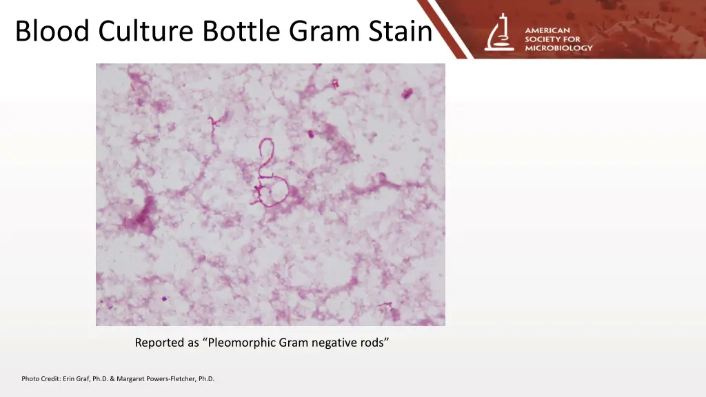 blood culture bottle gram stain