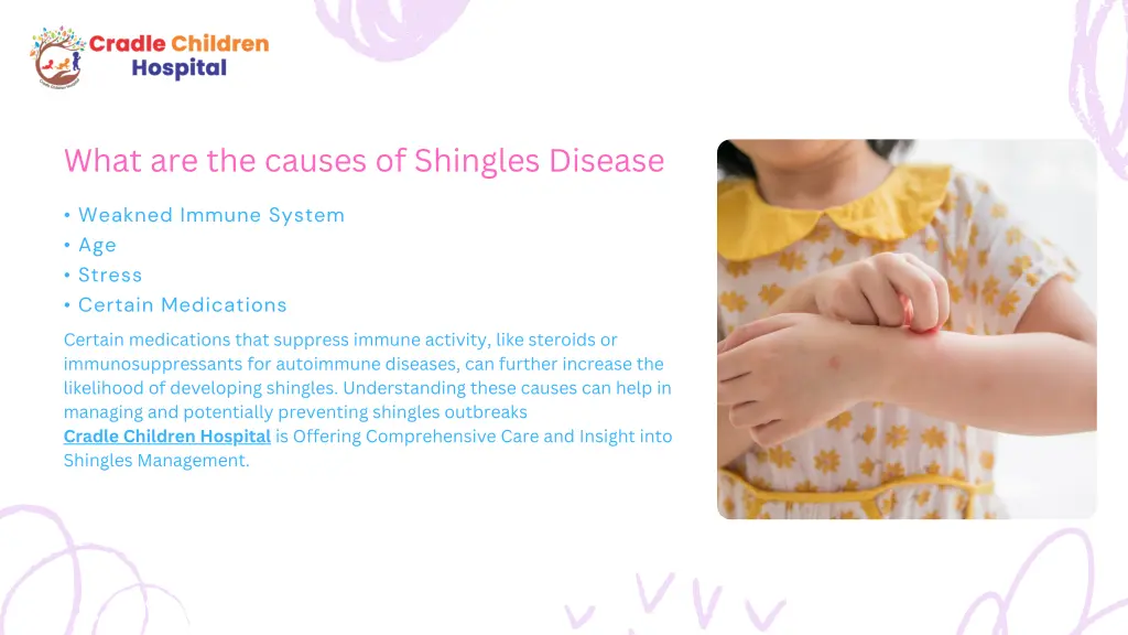 what are the causes of shingles disease what